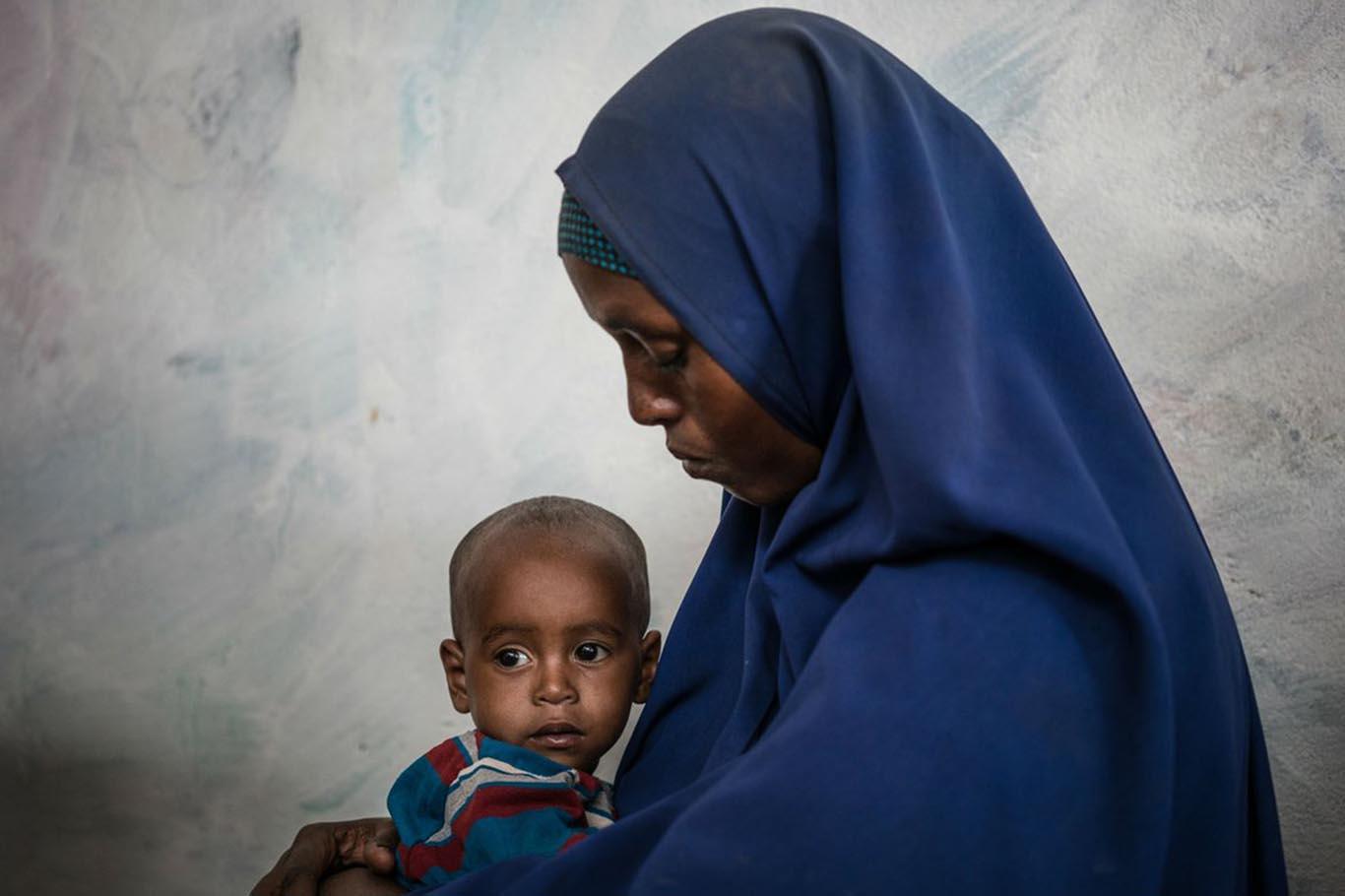 Somali’de 1,4 milyon çocuk aç Somali’de 1,4 milyon çocuk aç